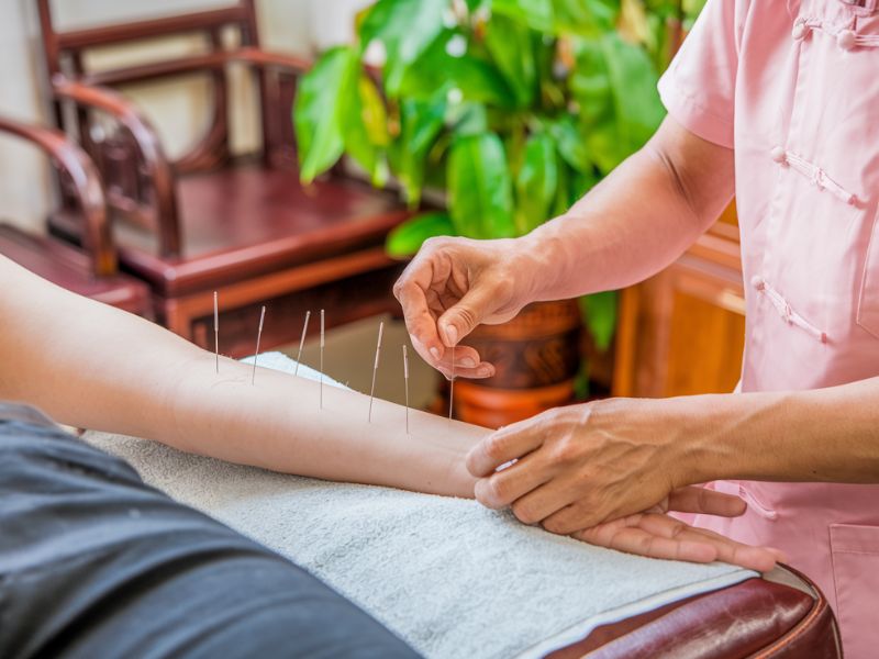Acupuntura para Idosos em Domicílio na Região da Lins de Vasconcelos